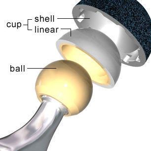 قبل العملية الجراحية